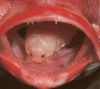 Tongue-eating isopod